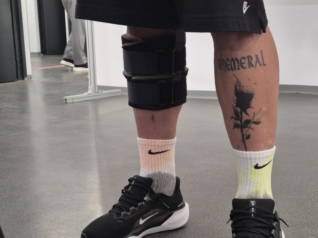 Genunchiul lui Denis Alibec, după ce s-a accidentat în FCSB - CFR Cluj 2-1